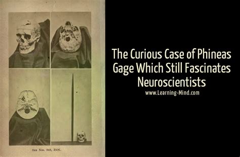 The Curious Case of Phineas Gage and Why It Still Fascinates ...