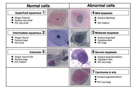 Herlev Pap smear Image classification - Part 1 (2019) - fast.ai Course ...