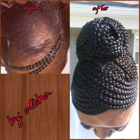 Braided Updo for Alopecia clients lisha_da_braider IG | Box braids ...