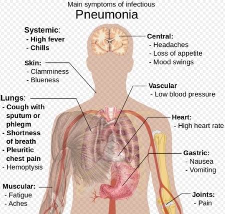 Diseases Caused by Microorganisms - PMF IAS