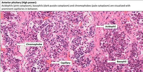 Brain – Pituitary – NUS Pathweb :: NUS Pathweb