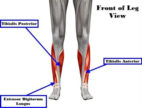 Medial Shin Splints