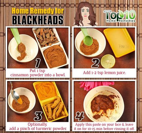 Home Remedies to Get Rid of Blackheads Fast | Top 10 Home Remedies