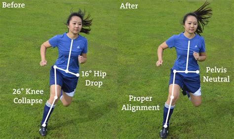 Who Needs Knees? Why ACL injury prevention matters - Stride Physio