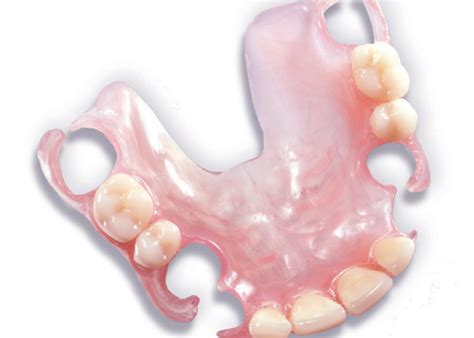 Maxillary Partial Denture Flexible Base