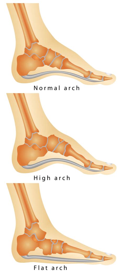 Arches Of Foot Diagram