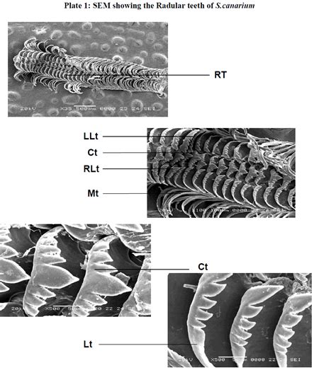 Scanning electron microscope (SEM) studies of Radula of the Dog C