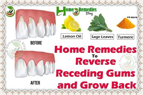 How Can I Treat My Dogs Gum Disease At Home | Home and Garden Reference