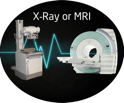 Difference Between MRI And X-ray - All Tech Blog