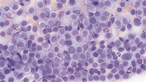 Canine histiocytoma, histiocytosis or histiocytic sarcoma; what happens ...