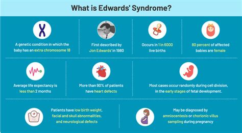 Causes and Treatment For Edwards’ Syndrome (Trisomy 18) in Children