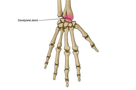 Wrist Condylar Joint