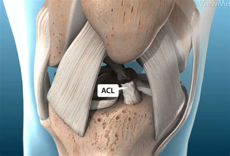 ACL Reconstruction | Best ACL surgeon in Tampa Bay