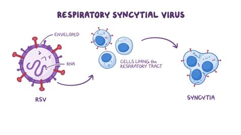 Texas Specialty Clinic What is respiratory syncytial virus? | Texas ...