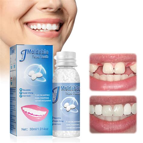 Buy Moldable False Teeth Tooth Repair Granules, Teeth Repair Kit, DIY ...