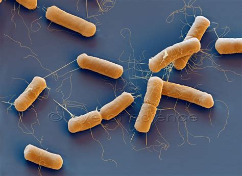 Bacteria and Fungus seen in the Scanning and Transmission Electron ...