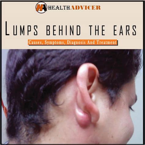 Lump Behind Ear Lobe No Pain at Thomas Joseph blog