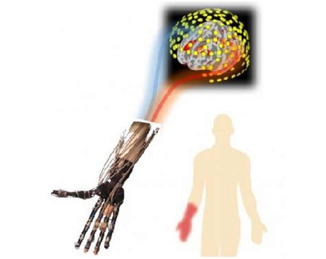 Phantom Pain - Causes, Symptoms & Phantom Pain Treatment (2022)