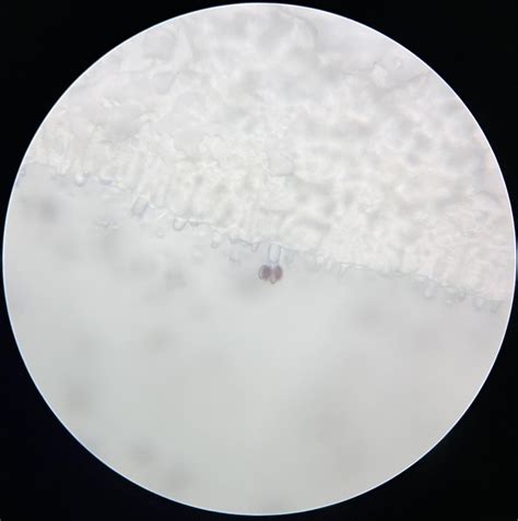 Captured this photo of a basidium with 4 basidiospores attached to it ...