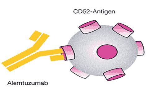 Case Studies Reveal New Alemtuzumab Side-effects