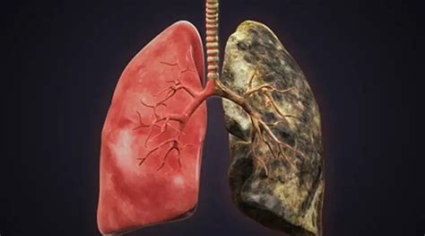 WATCH: Lungs of smokers vs non-smokers; this viral video shows the real ...