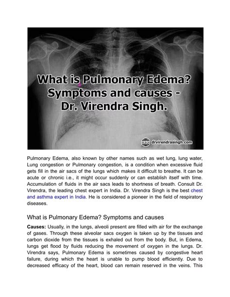 PPT - What is Pulmonary Edema_ Symptoms and causes – Dr. Virendra Singh ...