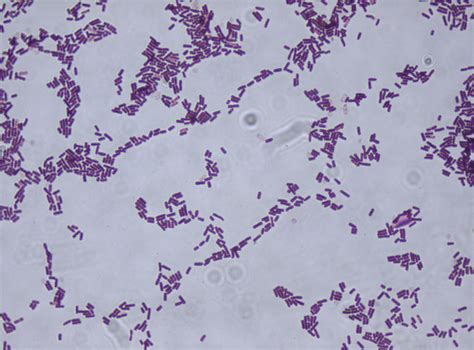 File:Bacillus subtilis Gram stain.jpg