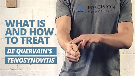 3 Ways To Treat De Quervains Tenosynovitis Physio Insights | Images and ...