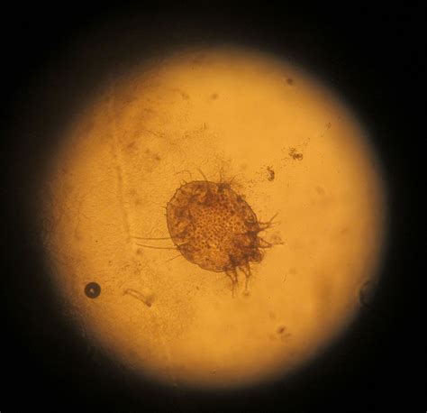 Scabies Eggs Under Microscope