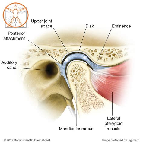 Temporomandibular joint (TMJ) Illustration by Body Scientific | Medical ...