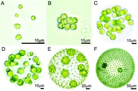 Planktonic Unicellular and Colonial algae - Algae Web