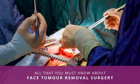 Everything You Must Know About Face Tumor Removal Surgery