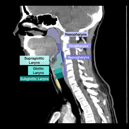 Internal Upper Airway Anatomy