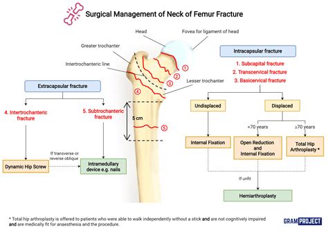 Management Of Fracture