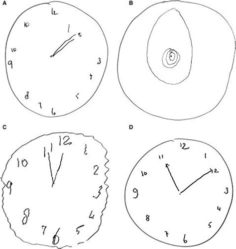 Clock-Drawing Test to Diagnose Alzheimer's - Sisters Hospitallers CIO