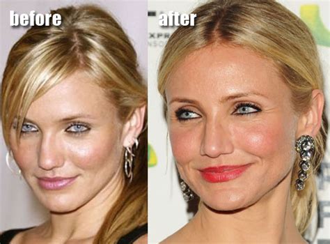 Cameron Diaz Plastic Surgery Before And After Face Photos