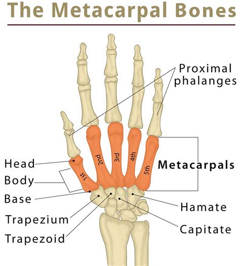 Metacarpal fracture causes, symptoms, diagnosis & treatment