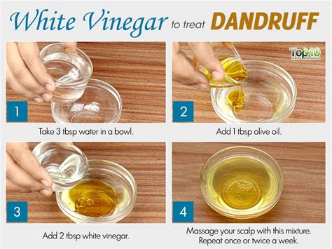 9 Helpful Home Remedies for Dandruff - eMediHealth | Home remedies for ...