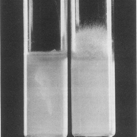 Cylindrical columella with collar (top) and conical columella (bottom ...