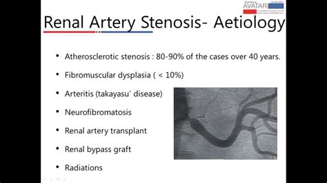 Renal Artery Stenosis Stent