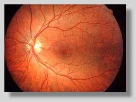 Fundus Photography Overview - Ophthalmic Photographers' Society