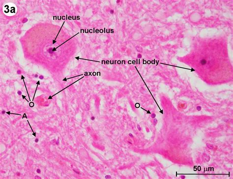 Human Nerve Cells Under Microscope