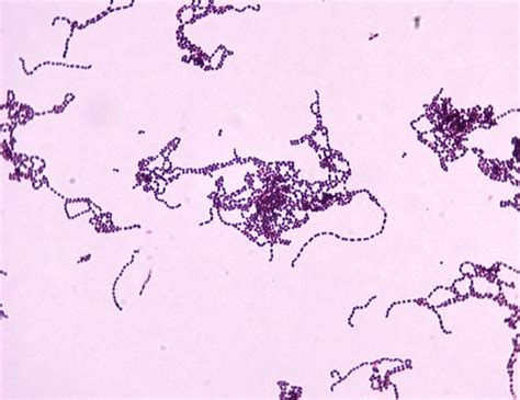 Group A Streptococcus Bacteria