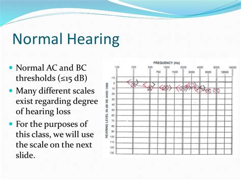 Audiogram interpretation