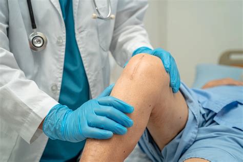 Knee Replacement Surgery Cost in India - HealthCareCost