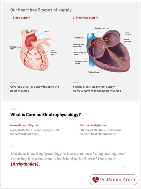 Cardiac Arrhythmias Treatment in Delhi - Dr. Vanita Arora