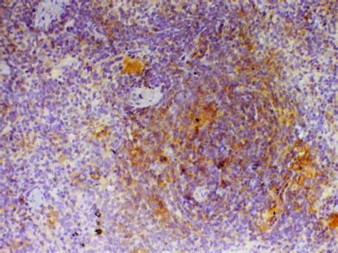 CD154 (CD40 Ligand) Antibody (PA5-78983)