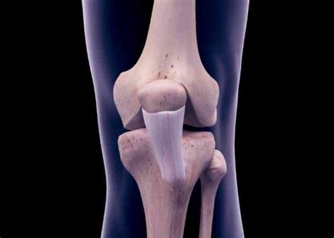 Medial Patellofemoral Ligament Injury | MPFL Specialist | Sugar Land ...