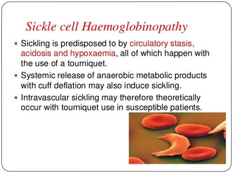 TOURNIQUET AND ITS EFFECTS