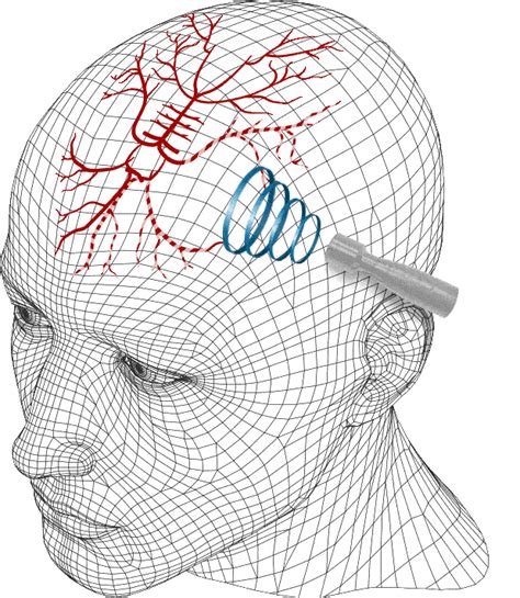 Heart Smart Inc.Digital Transcranial Doppler Systems - Heart Smart Inc.